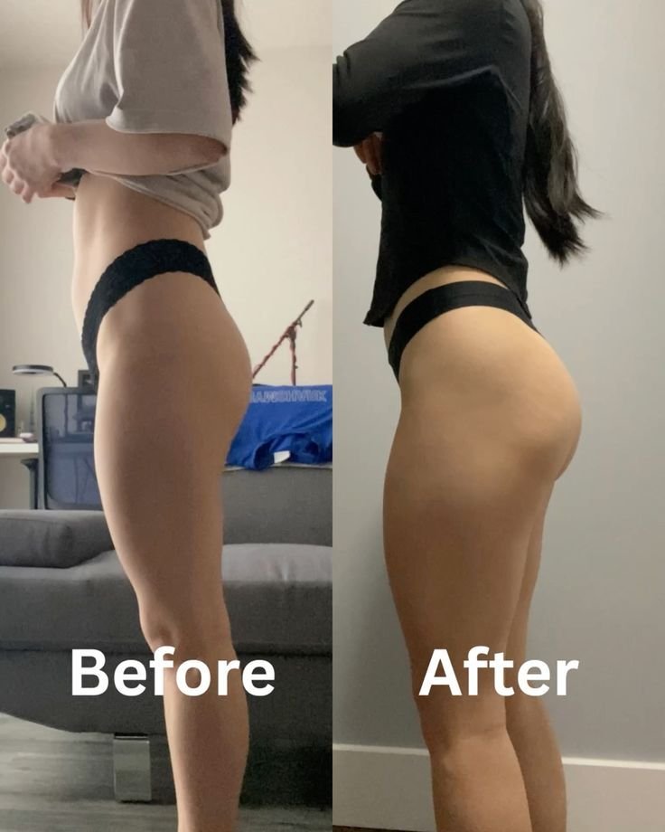 Before and after body filler case 1