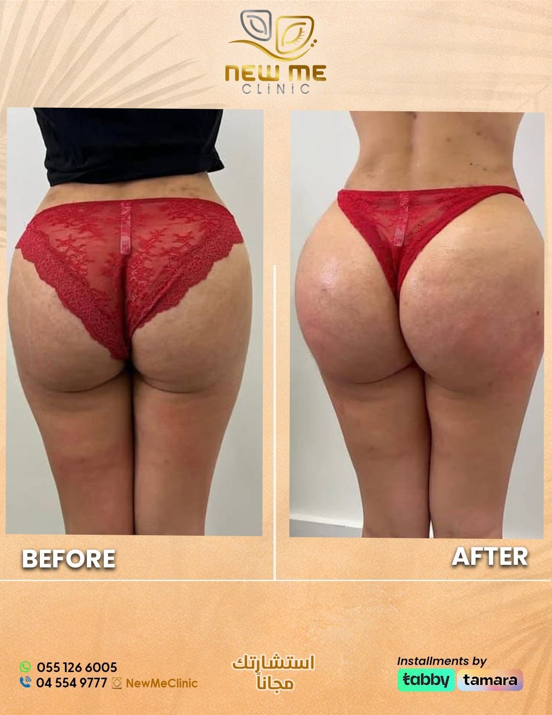 Before and after body filler case 2